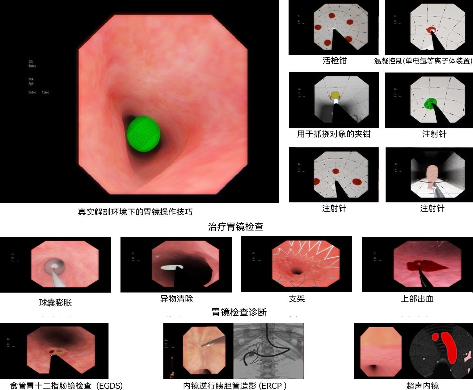 上消化道內(nèi)窺鏡