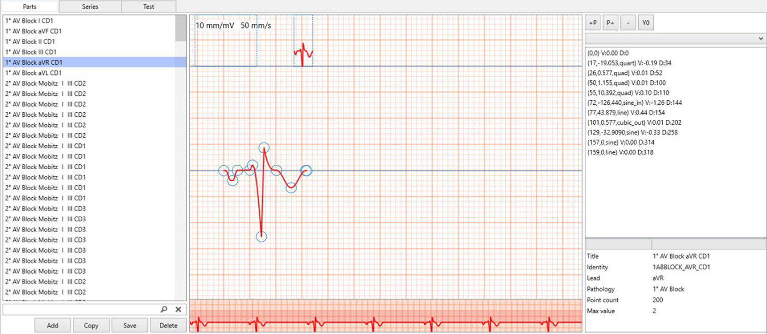 從我們的圖庫(kù)中選擇一個(gè)心律，想要更具體的信息嗎?
用我們的軟件很容易創(chuàng)造任何心律。