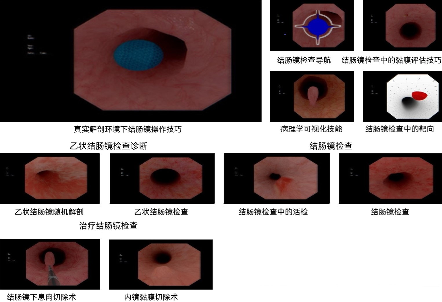 下消化道內(nèi)鏡
